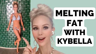 MELTING FAT with KYBELLA | Kybella before and after
