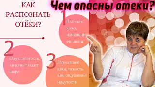 💊 Отчего могут быть отеки?