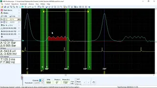 Analyzing Picoscope cylinder pressure graph by USB Autoscope software Part 2