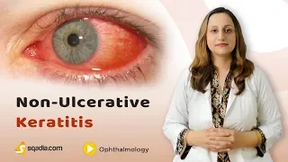 Non-Ulcerative Keratitis | Ophthalmology Student Lecture | Medical Education | V-Learning