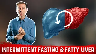 Can Intermittent Fasting Reverse a Fatty Liver? Fasting as Remedy for Fatty Liver – Dr. Berg