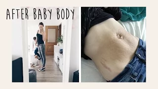 After Baby Body - Bauch 8 Monate nach der Schwangerschaft - Update