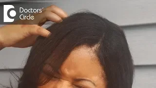 Reasons for itchy scalp and how to treat it - Dr. Rasya Dixit