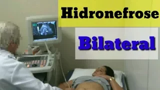 Diagnóstico,Hidronefrose Bilateral!