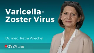 Windpocken & Gürtelrose: Gemeinsamkeiten und Schutzmassnahmen | Dr. med. Petra Wiechel | QS24