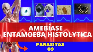 AMEBÍASE - ENTAMOEBA HISTOLYTICA - PARASITOLOGIA| INFECTOLOGIA