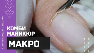 МАКРО комби маникюр 🔍Коррекция КЛЮЮЩЕГО ногтя акригелем 💅 Геометрический маникюр 2020