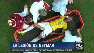 Fractura de Neymar: una lesión frecuente en deportes de impacto