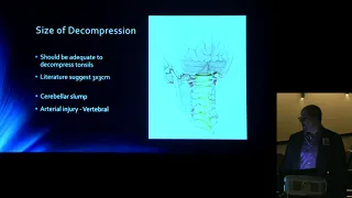 "Chiari Malformation: Diagnosis, Management & Treatment" - Ian Heger, MD