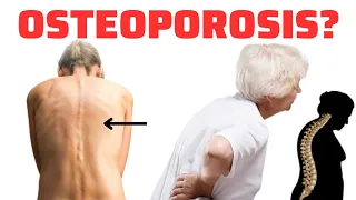 You will NEVER get OSTEOPOROSIS if you take this natural MEDICINE!