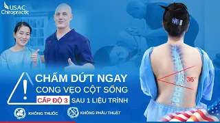 Kỳ tích: Trị cong vẹo cột sống thành công sau 23 năm chung sống | USAC Chiropractic