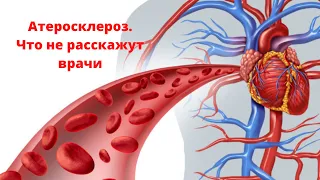 Атеросклероз. Что не расскажут врачи. Рекомендации врача.  Анна Котельникова