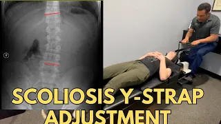 Scoliosis Care: High Schooler Gets Y-Strap Chiropractic Adjustment to Help Restore Spine #ystrap