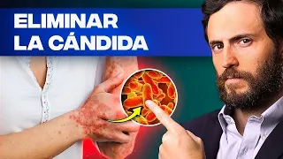 COMO ELIMINAR CANDIDA DE TU ORGANISMO NATURALMENTE