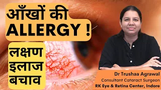 Eye Allergy. Know about symptoms, treatment and prevention.