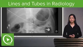 Lines and Tubes in Radiology – Radiology | Lecturio