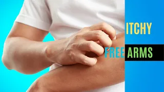 Natural Remedies and Home Care for Brachioradial Pruritus  Tips for Soothing Itchy Arms