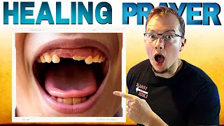 This EASY Prayer Will HEAL TEETH!!