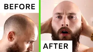 HARRY'S RAZOR - BALDING HEAD SHAVE REVIEW