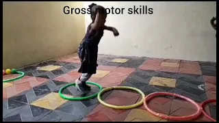 gross motor skills