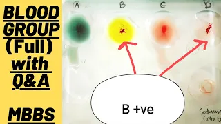 Blood Group Practical (Full) with Question & answers| MUHS | #mbbs #medicine #aiims #physiology