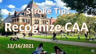 Stroke Tips: recognize Cerebral Amyloid Angiopathy