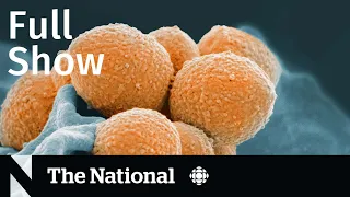 CBC News: The National | Spike in severe strep A infections