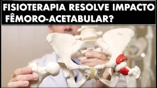 Fisioterapia resolve Impacto Femoro-acetabular?