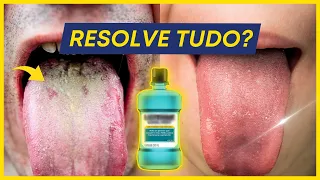 ENXAGUANTE BUCAL ACABA COM A LÍNGUA BRANCA? VERDADE REVELADA.