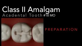 Class II Amalgam Preparation - #18 MO Acadental Typodont