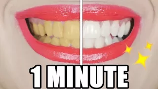 9 DIYS DIE JEDER IN 1 MINUTE MACHEN KANN! 😍 HACKS ZUM ZÄHNE AUFHELLEN, GEGEN PICKEL | KINDOFROSY