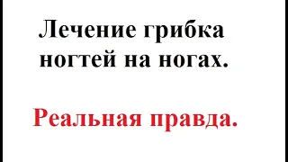 Лечение грибка ногтей на ногах. Настоящая правда.