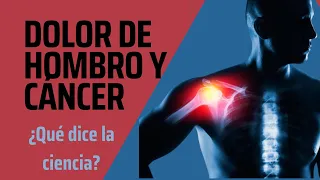 DOLOR DE HOMBRO Y CÁNCER- ¿Qué signos y síntomas nos pueden hacer sospechar?