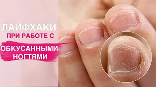 Лайфхаки маникюра на ОБКУСАННЫЕ ногти