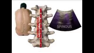 LUMBAR SPINE SONOANATOMY