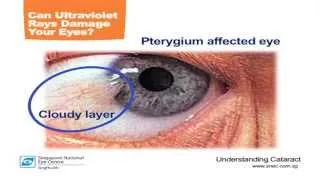 How To Prevent Eyesight Deterioration - SNEC (Singapore National Eye Centre)