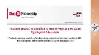 COVID-19/TB - Diagnostic Delays and Unrecognized Risk for Progression of LTBI to TB Disease