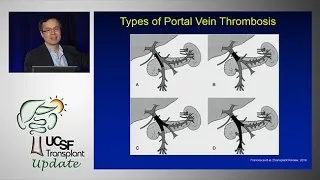 Portal Vein Thrombosis:  Medical and Surgical Consideration - UCSF Liver Transplant Conference 2014