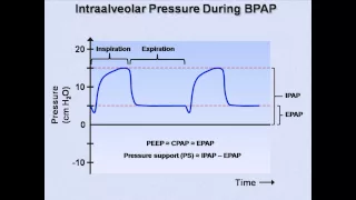 Non-Invasive Positive Pressure Ventilation (Mechanical Ventilation - Lecture 6)