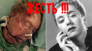 ЖЕСТЬ!!!Женщину, съели живьем клещи