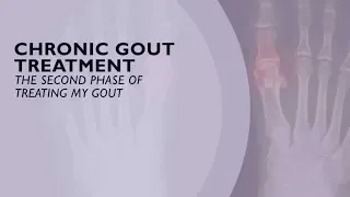 Chronic Gout Treatment - The Second Phase of Treating Gout (6 of 6)