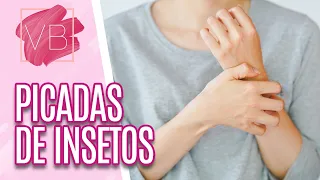 Picadas de Inseto: saiba como prevenir reações alérgicas - Você Bonita (14/02/2023)