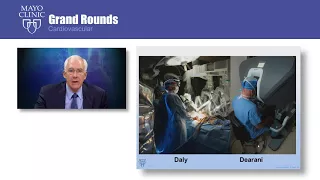 Mayo Clinic Grand Rounds – Robotic Approach to Mitral Valve Repair: Mayo Clinic Experience