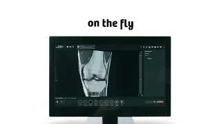 MAGNETOM Free. Platform with myExam Autopilot | Siemens Healthineers | Elevator Pitch