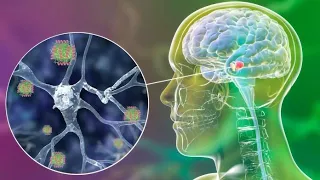 What's the latest on Parkinson’s Disease