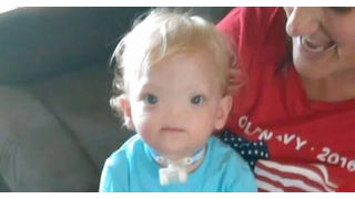 Alabama Boy Born Without a Nose, Known as ‘Miracle Baby,’ Dies at Age 2