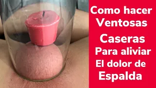 Como hacer ventosas caseras para aliviar el dolor de espalda