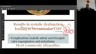 Cardiomyopathy types(dilated, hypertrophic, restrictive) by Doc Fazal's Online Class video(Pathoma)