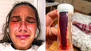 Girl Has Intense Itch Inside Nose - Visits Doctors And Makes Horrifying Discovery