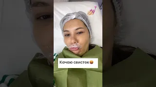 НАКАЧАЛА ГУБЫ и ЖАЛЕЮ😭 (что так мало)